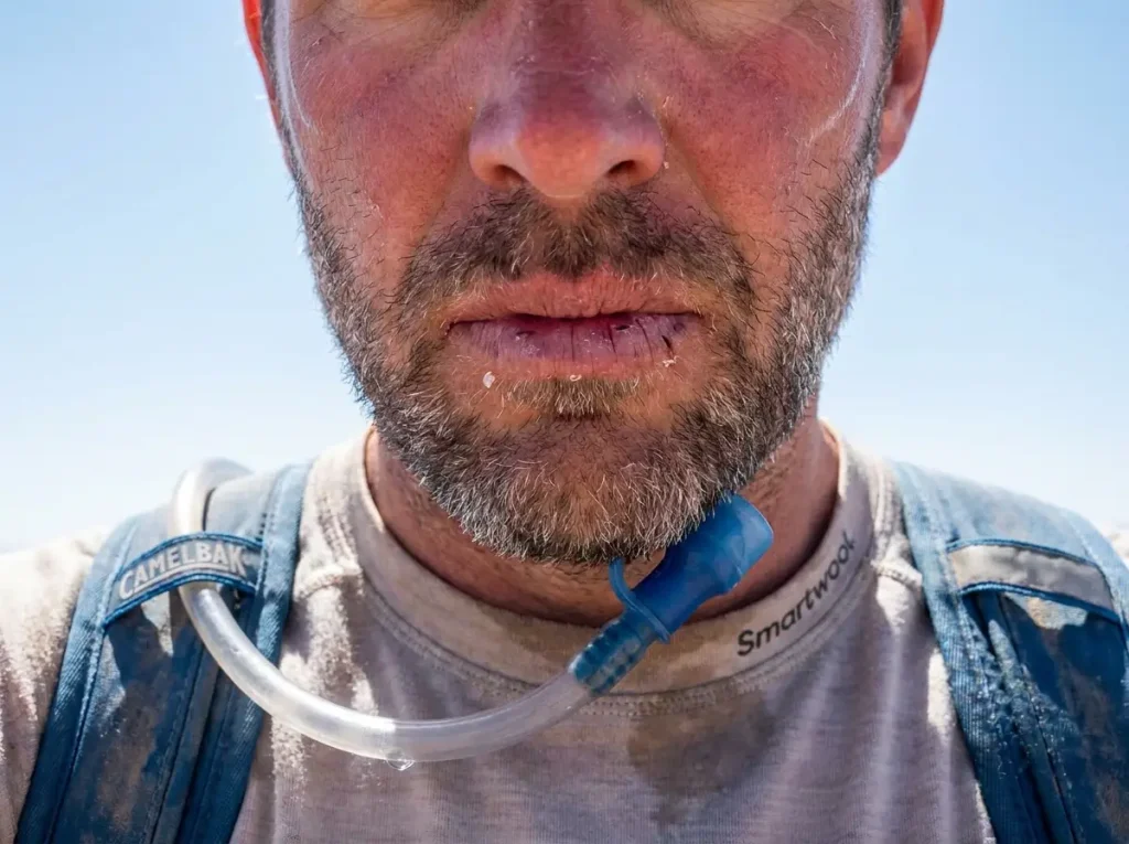 Close-up of dry cracked lips and sunburned skin on a hiker at altitude